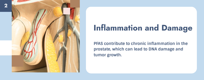 inflammation and prostate cancer