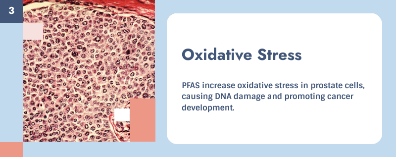 dna damage and prostate cancer