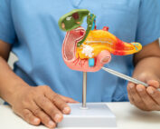 pfas and pancreatic cancer
