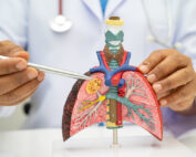 pfas and lung cancer