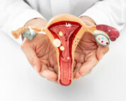 pfas and ovarian cancer