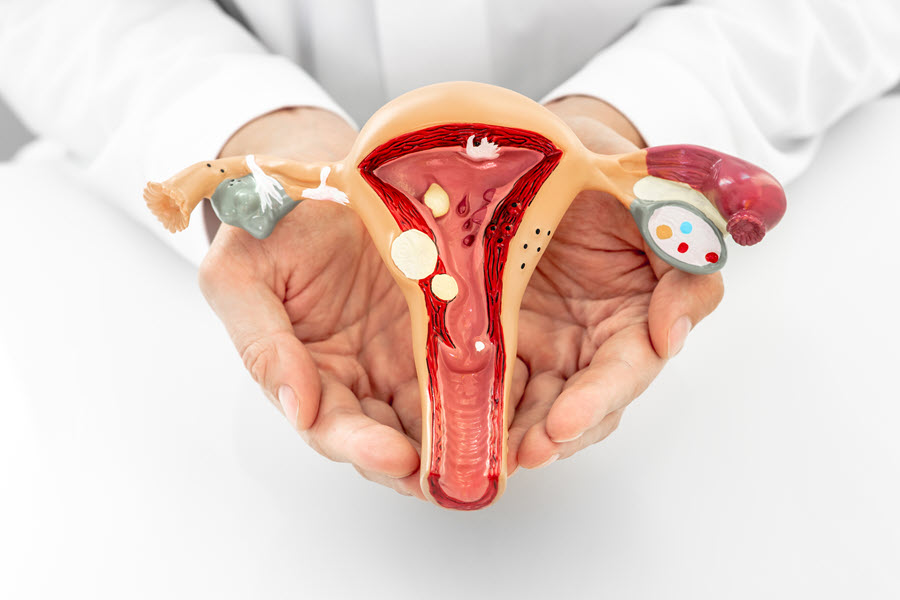 pfas and ovarian cancer
